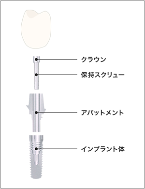 とき歯科・天神山につきまして